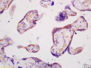 ABCG2 Rabbit Polyclonal Antibody