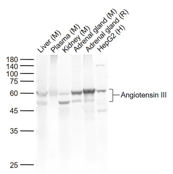 Angiotensin III Rabbit Polyclonal Antibody