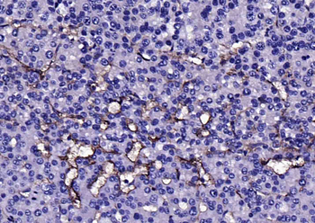 CD105 Rabbit Polyclonal Antibody