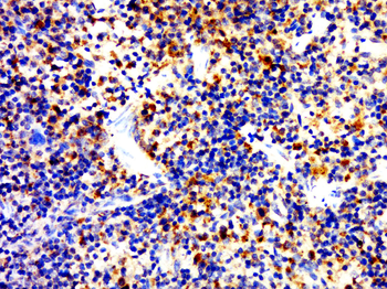 CD4 Rabbit Polyclonal Antibody