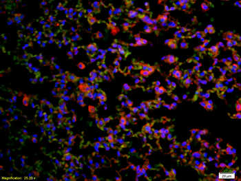CD4 Rabbit Polyclonal Antibody