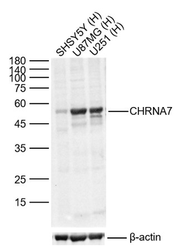 CHRNA7 Rabbit Polyclonal Antibody