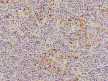 CD8 Rabbit Polyclonal Antibody