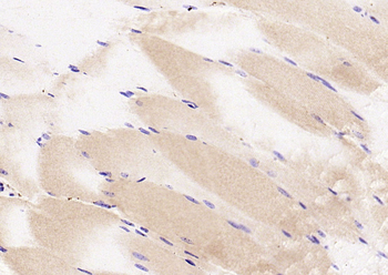 Phospho-CDKN1B (Ser10) Rabbit Polyclonal Antibody