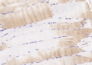 Phospho-CDKN1B (Ser10) Rabbit Polyclonal Antibody
