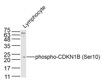 Phospho-CDKN1B (Ser10) Rabbit Polyclonal Antibody