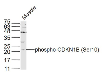 Phospho-CDKN1B (Ser10) Rabbit Polyclonal Antibody