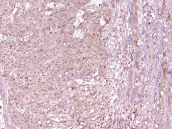 Phospho-CDK7 (Thr170) Rabbit Polyclonal Antibody