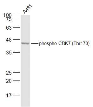Phospho-CDK7 (Thr170) Rabbit Polyclonal Antibody
