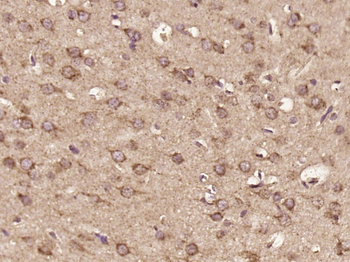 C16orf5 Rabbit Polyclonal Antibody