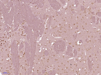 Phospho-DNA PKcs (Ser2056) Rabbit Polyclonal Antibody