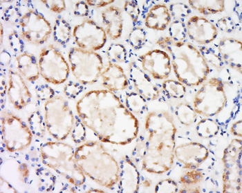 Dematin Rabbit Polyclonal Antibody