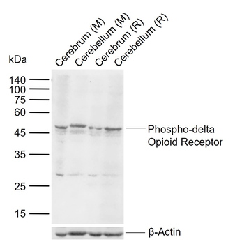 Phospho-delta Opioid Receptor (Ser363) Rabbit Polyclonal Antibody