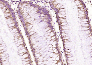EpCAM Rabbit Polyclonal Antibody