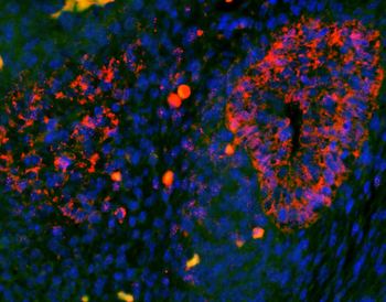 EpCAM Rabbit Polyclonal Antibody