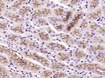 ET-1 Rabbit Polyclonal Antibody