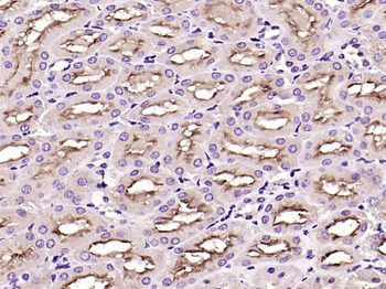 ET-1 Rabbit Polyclonal Antibody
