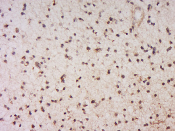 EYA1 Rabbit Polyclonal Antibody