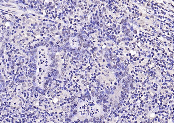 Phospho-FoxO1 (Ser319) Rabbit Polyclonal Antibody