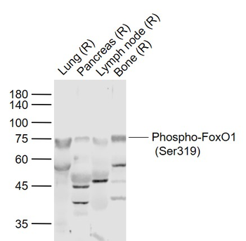 Phospho-FoxO1 (Ser319) Rabbit Polyclonal Antibody