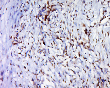 Phospho-FoxO1 (Ser319) Rabbit Polyclonal Antibody