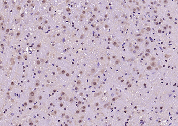 Phospho-FoxO1 (Ser319) Rabbit Polyclonal Antibody