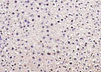 Phospho-FoxO1 (Ser319) Rabbit Polyclonal Antibody