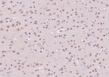 Phospho-FoxO1 (Ser319) Rabbit Polyclonal Antibody