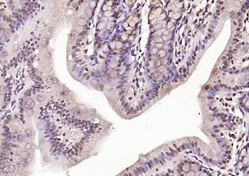 Phospho-FoxO1 (Ser319) Rabbit Polyclonal Antibody