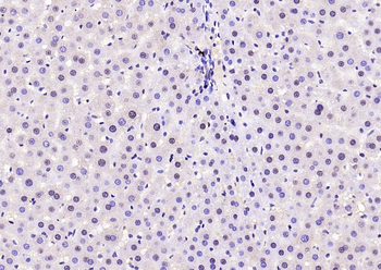 Phospho-FoxO1 (Ser319) Rabbit Polyclonal Antibody