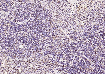 Phospho-FoxO1 (Ser319) Rabbit Polyclonal Antibody