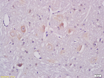 Ganglioside GM1 Rabbit Polyclonal Antibody