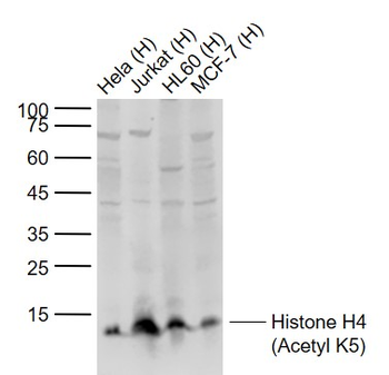 Histone H4 (Acetyl K5) Rabbit Polyclonal Antibody