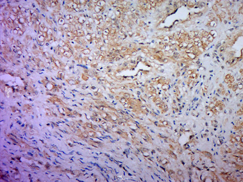 HCN2 Rabbit Polyclonal Antibody