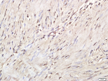 Phospho-HSF1 (Ser326) Rabbit Polyclonal Antibody