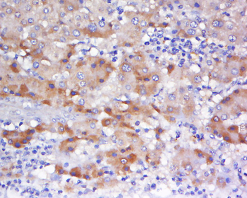 Phospho-HSF1 (Ser326) Rabbit Polyclonal Antibody