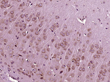 IGF 1 Rabbit Polyclonal Antibody