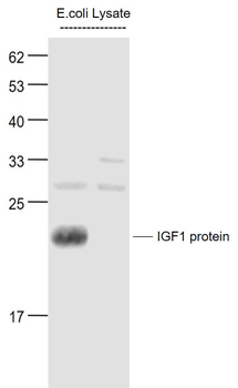 IGF 1 Rabbit Polyclonal Antibody
