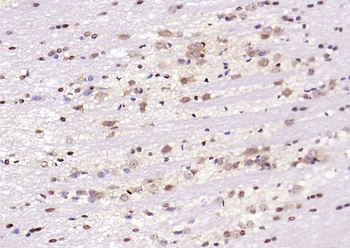 Phospho-JNK1 + JNK2 + JNK3 (T183 + T183 + T221) Rabbit Polyclonal Antibody