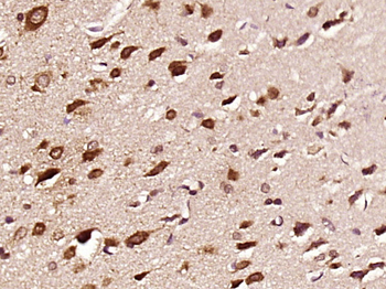 Phospho-JNK1 + JNK2 + JNK3 (T183 + T183 + T221) Rabbit Polyclonal Antibody