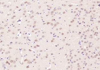 Phospho-JNK1 + JNK2 + JNK3 (T183 + T183 + T221) Rabbit Polyclonal Antibody