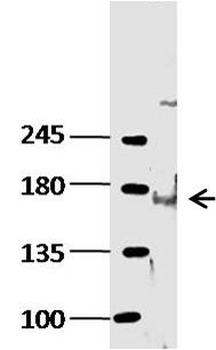 KDM6B Rabbit Polyclonal Antibody