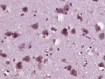 LOX 1 Rabbit Polyclonal Antibody