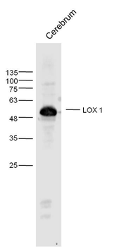 LOX 1 Rabbit Polyclonal Antibody