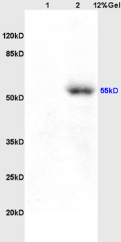 MCT1/Malignant T cell amplified sequence 1 Rabbit Polyclonal Antibody