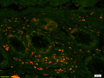 MCT1/Malignant T cell amplified sequence 1 Rabbit Polyclonal Antibody