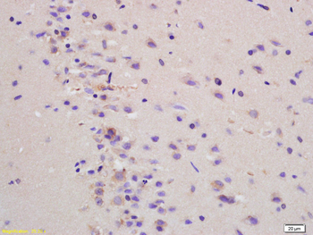 MCT1/Malignant T cell amplified sequence 1 Rabbit Polyclonal Antibody