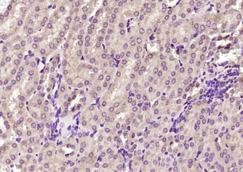 MTA3 Rabbit Polyclonal Antibody