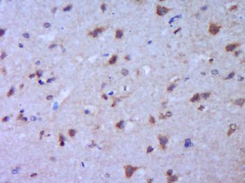 MAP2 Rabbit Polyclonal Antibody