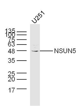 NSUN5 Rabbit Polyclonal Antibody